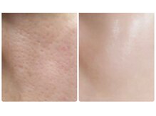 サロンドラッジ(Salon de Raggi)/【IPLフェイシャル】