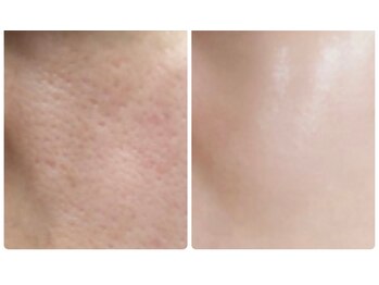 サロンドラッジ(Salon de Raggi)/【IPLフェイシャル】