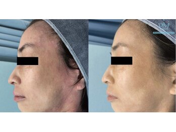 リメイク 広尾(REMAKE)/