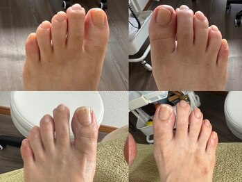 ベーネ(bene)の写真/あなたの爪のお悩みに徹底アプローチ！≪フットケア専門サロン≫で本格ネイルケア◎美しく健康的な足元へ♪