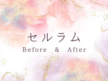 ココロ(COCORO)/岐阜県初導入!セルラム