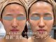 レイビス 盛岡店(RAYVIS)の写真