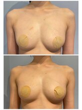 ルナグランデ(Luna grande.)/最新結果写真