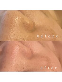 メナードフェイシャルサロン 岐阜茜部/エイジングケア/フェイシャル