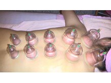 エステルーム チュラ 那覇上間店(Chura)/血行促進カッピング