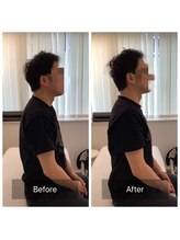 ナオル整体 新宿院(NAORU整体)/30代男性-姿勢矯正1ヶ月経過