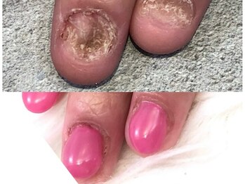 グレースレディ/すごくないですか？同じ指です