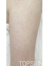 トップスキン 表参道(TOPSKIN)/毛○性苔癬/サメ肌のお悩みにも