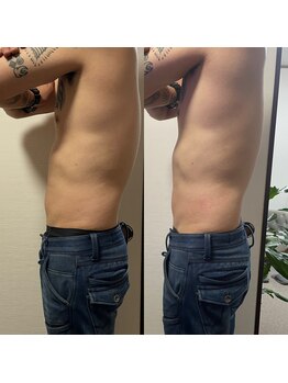 ティグレ 岡山店(TIGRE)/痩身メンズエステ(上半身)