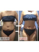 アンジュ(Ange)/セルゼロで綺麗なボディメイク★