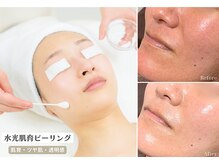 スリースリー(THREE THREE)の雰囲気（人気No.1【うるツヤ肌 水光肌育ピーリング】一度でも効果実感◎）