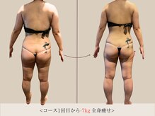 エル 麻布十番(LllL)/【痩身】1回目から‐7kg