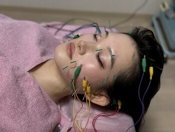 サロン ド ハリッシュ(Salon de HARISH)/立体造顔電気美容鍼 60本