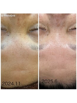 private salon Ponola【ポノーラ】/ラミネーションピール