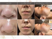 リエイト(Re:eight)の雰囲気（お肌のお悩みに合わせたメニューを豊富にご用意しております◎）