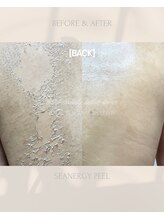 ラヴィン なんばスカイオ店(Lovin)/シーナジーピーリング