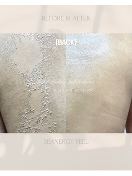 ラヴィン なんばスカイオ店(Lovin)/シーナジーピーリング