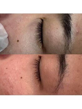 クレビア(CREBIA)/【シミ・シミケア専門店】沖縄県