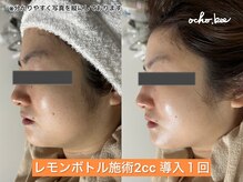 オチョビー(ocho.bee)/レモンボトル導入