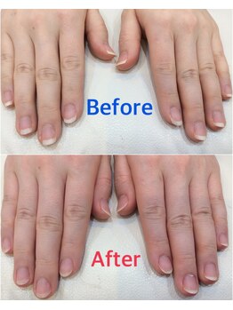 シャンネイルケアサロン(Shan Nail caresalon)/ハンドケア(BeforeーAfter)
