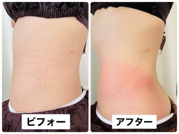 プラーナ(PRANA)/