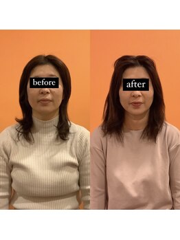 からだリカバリーラボ/小顔矯正