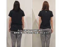 ナナ 札幌店(NANA)/20代会員様のビフォーアフター