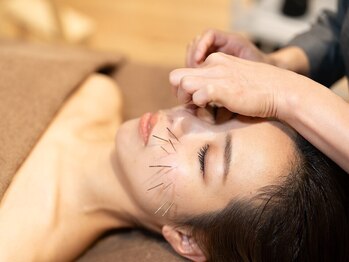 鍼灸パルシェの写真/パルシェの【疲れもとれる美容鍼】で若々しい印象へ！周りから「痩せた？」と言われること間違いなし☆