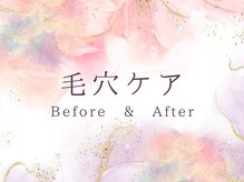 ココロ(COCORO)/毛穴洗浄　ビフォー＆アフター