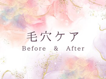 ココロ(COCORO)/毛穴洗浄 ビフォー&アフター