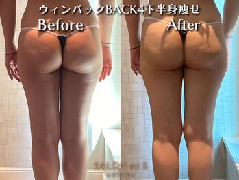 サロン ド エス アオヤマ(SALON DE S AOYAMA)/激変！即効下半身痩せ美脚ケア