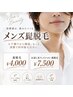 ヒゲ脱毛(鎮静美容液込)¥4,000 (+3,500でお試し光フェイシャル可能◎)