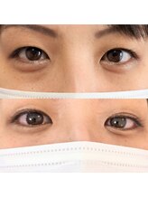 プライベイトスペース コト(PRIVATE SPACE COTO)/アイストレッチ