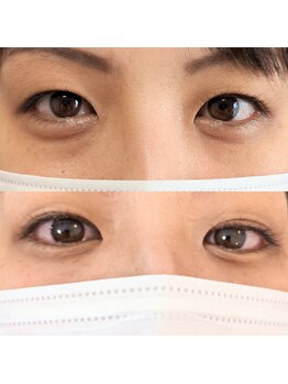 プライベイトスペース コト(PRIVATE SPACE COTO)/アイストレッチ