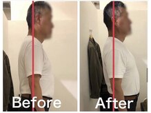 カワル整体 上通り院/手が痺れて夜中に目を覚ます