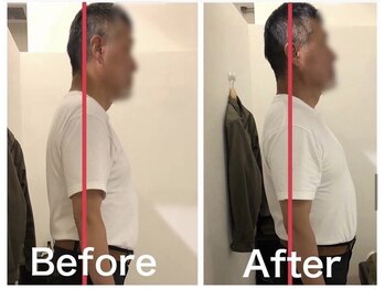 カワル整体 上通り院/手が痺れて夜中に目を覚ます