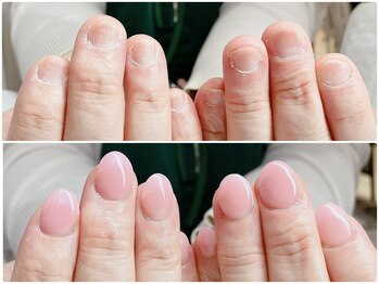 オー 町田モディ店(Oh!)/深爪矯正で美爪育成☆