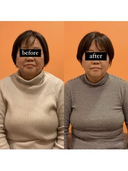 からだリカバリーラボ/小顔矯正