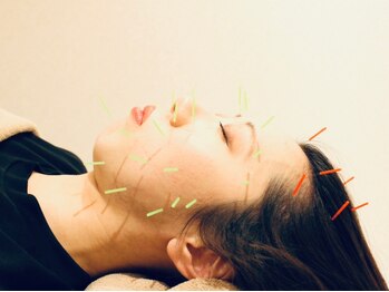 クマノミ美容鍼灸 イオン上尾院(KUMANOMI美容鍼灸)/エラ張り,食いしばりに！