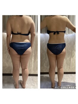 サロン ド スー(Salon de Suu)/ウルトラ全身