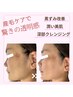 【脱シェービング！】全顔ワックス脱毛コース艶肌パック付き☆¥11.000
