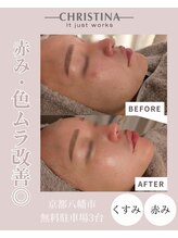 エイム(eim)/アンストレス