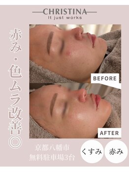 エイム(eim)/アンストレス