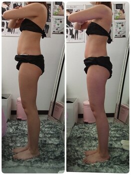 輝 らいと/痩身ダイエット1回目