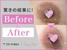 ローマピンク乳首キャンペーン【アフタークリーム3本プレゼント】