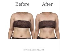 プランツ(PLANTS)/30代／２回／お腹ケア・腸活