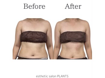 プランツ(PLANTS)/30代／２回／お腹ケア・腸活