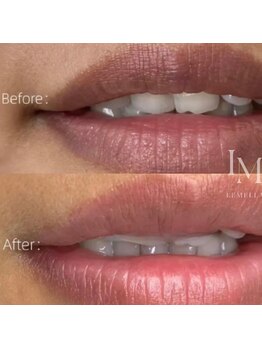 ピュアソル 枚方店(Puresol)/