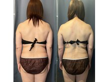 ネイルアンドビューティー モアリボン(Nail&Beauty More Libbon)の雰囲気（パワーレメディ2回目/最短でワンサイズダウンが叶う！！）