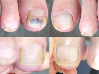 ブリエネイルの写真/清潔感が際立つメンズネイルケアで指先へ。フットケアで足元から自信をまとう優雅な時間を☆